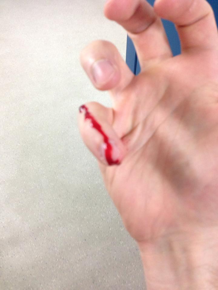 Sliced Finger